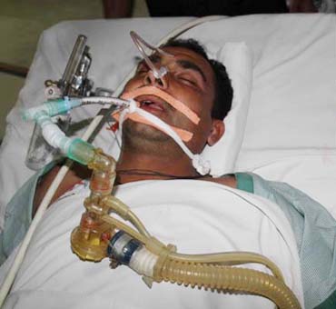 सपा प्रत्याशी के गनर को लगी गोली, कैलाश अस्पताल में भर्ती