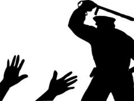 NOIDA: शराब पीने के लिए रुपये ना देने पर पुलिसकर्मी ने बेरहमी से पीटा